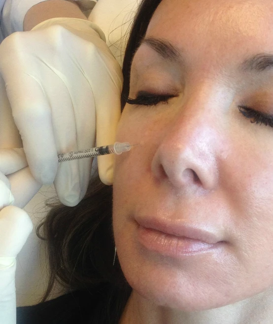 Airbrush with Botox: Micro Botox injections can diminish oily skin and shrink pores: Body Tonic RX journal article, Austin, TX