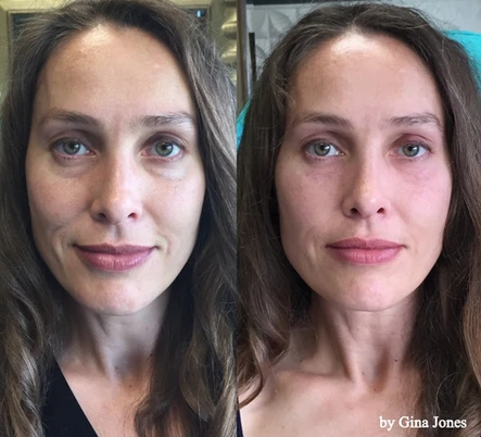All About the Eyes: Treating Above the Mask!: Body Tonic RX journal article, Austin, TX