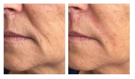 Butter for Your Face: Vollure Makes a Smooth Entrance: Body Tonic RX journal article, Austin, TX