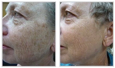Fall is Coming: Get Out the Decorations + Get Off the Sun Damage!: Body Tonic RX journal article, Austin, TX