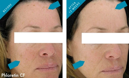 Fall is Here: Let’s Fry That Sun Damage: Body Tonic RX journal article, Austin, TX