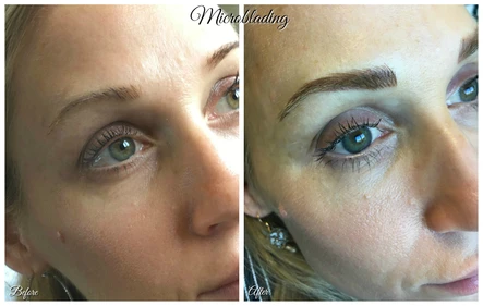 Filler Up! 44th Birthday Blog: Body Tonic RX journal article, Austin, TX