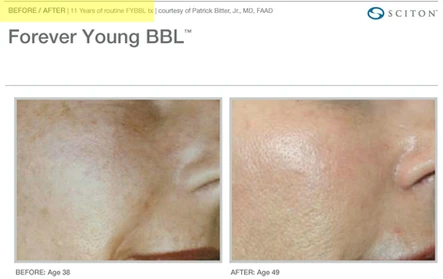 Fountain of Youth: Forever Young BBL: Body Tonic RX journal article, Austin, TX