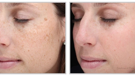 Hello Halo! A Deep Dive Into Treatment and Healing: Body Tonic RX journal article, Austin, TX