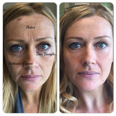 “I’m A Before Picture”: Deconstructing Spectacular Treatment Results: Body Tonic RX journal article, Austin, TX