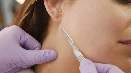 Is Dermaplaning At-Home the Same as a Professional Treatment?: Body Tonic RX journal article, Austin, TX