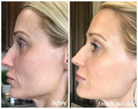 Kardashians, Crack Dip, and Changing Up the Anti-Aging Plan: Body Tonic RX journal article, Austin, TX