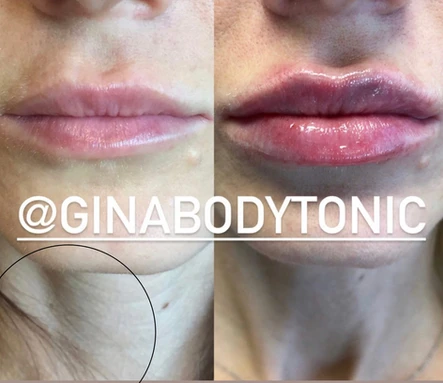 Notice the Lips, Not the Neck: Body Tonic RX journal article, Austin, TX