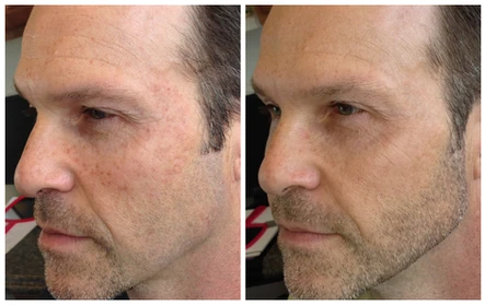 Part One: Injections + Skincare for Men: Body Tonic RX journal article, Austin, TX