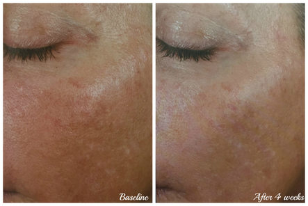 The Before and Afters of Better Skin: Body Tonic RX journal article, Austin, TX