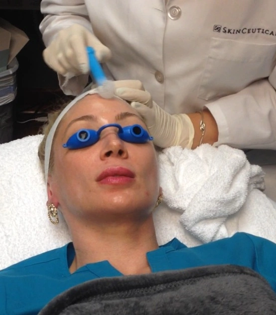 Skin Ceuticals Micropeel!!! (and some Thanksgiving Gratitude): Body Tonic RX journal article, Austin, TX