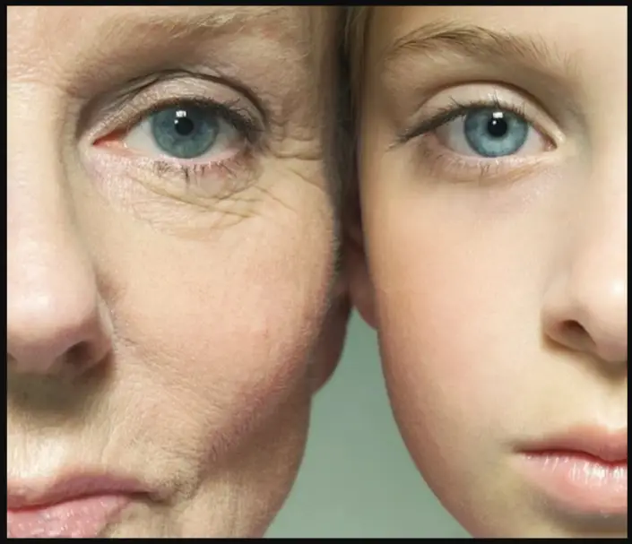Turn Back Time? Optimal Correction With Dermal Filler: Body Tonic RX journal article, Austin, TX