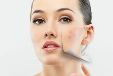 Teen Acne: Do’s and Don’t’s for the Plague on the Face!: Body Tonic RX journal article, Austin, TX