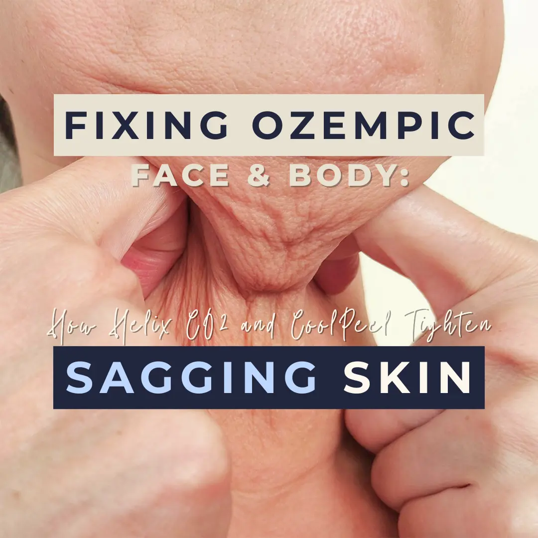 Fixing Face & Body: How Helix CO₂ and CoolPeel Tighten Sagging Skin: Body Tonic RX journal article, Austin, TX
