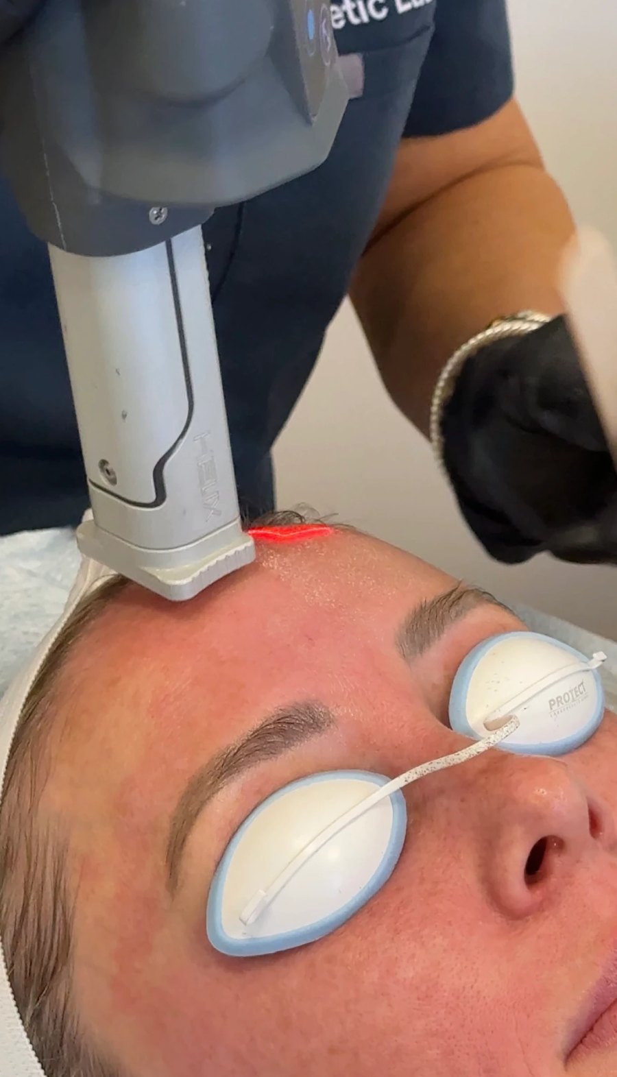 Not Your Mom’s CO₂ Laser: Body Tonic RX journal article, Austin, TX